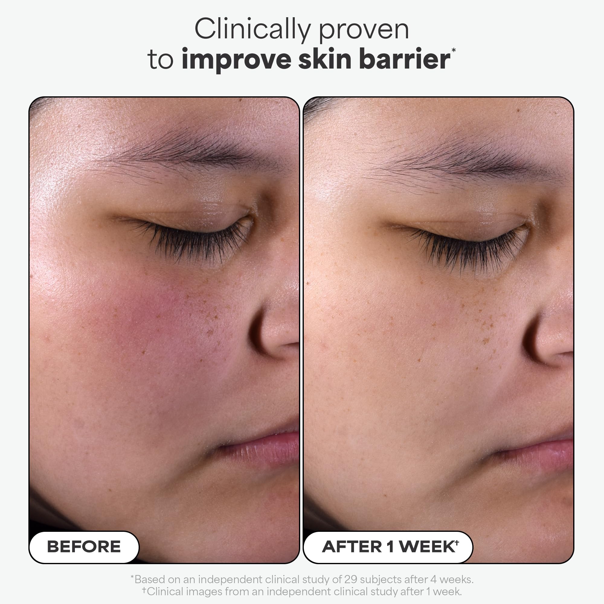 Paula's Choice SKIN PERFECTING 2% BHA Liquid Exfoliant with Salicylic Acid, Facial Polish for Enlarged Pores, Wrinkles & Fine Lines, Suitable for Blackhead-Prone Skin, Fragrance-Free