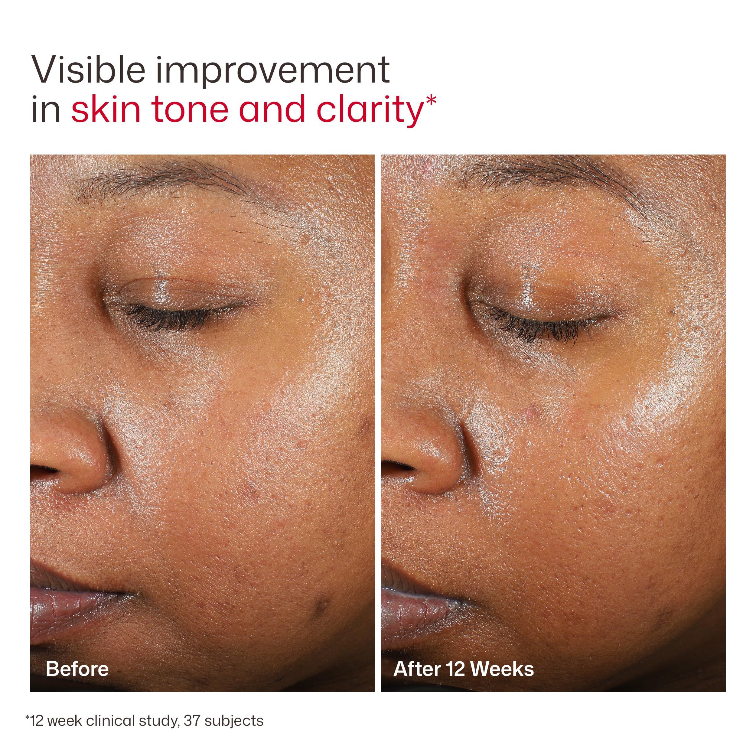 EltaMD UV Clear Tinted Face Sunscreen SPF 46, Oil Free Sunscreen for Sensitive Skin with Zinc Oxide, Dermatologist Recommended